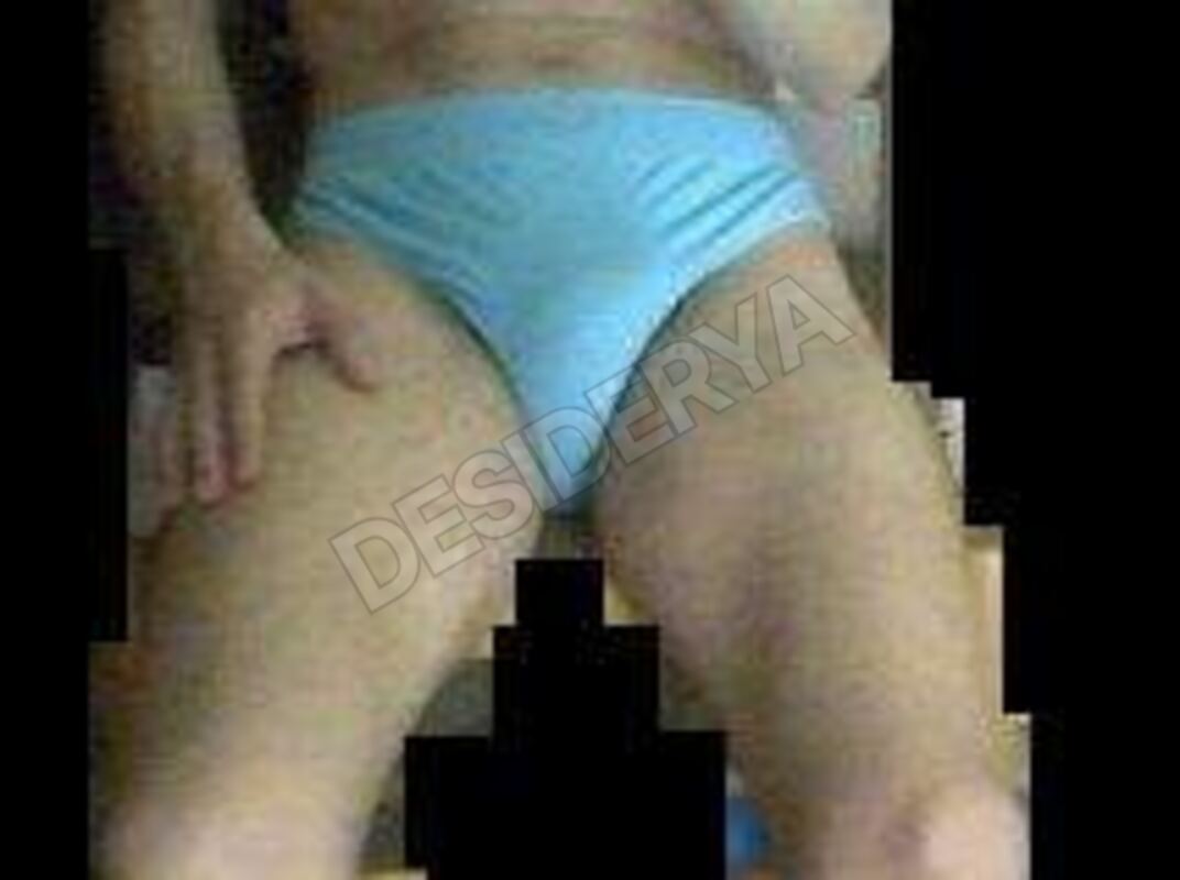 Kisssmack5556296