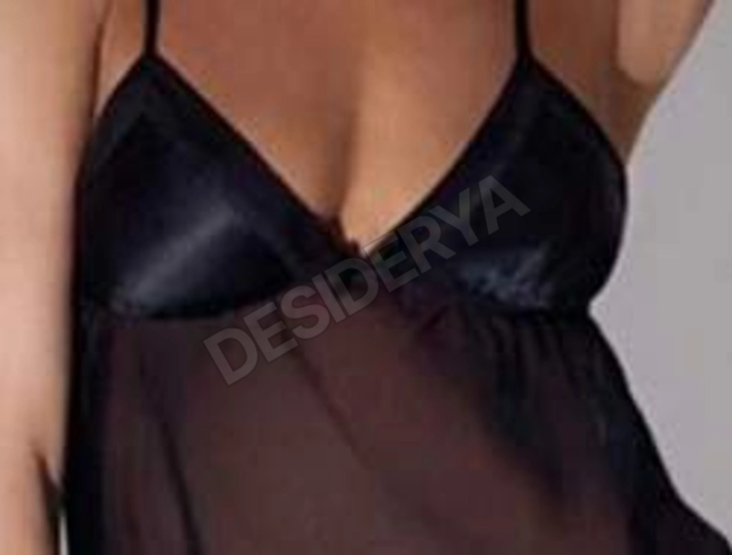 eros1e1intrigo5513891
