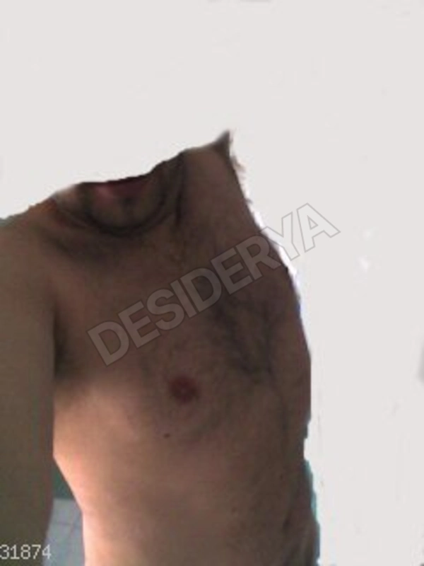 2okkipenetranti5278545