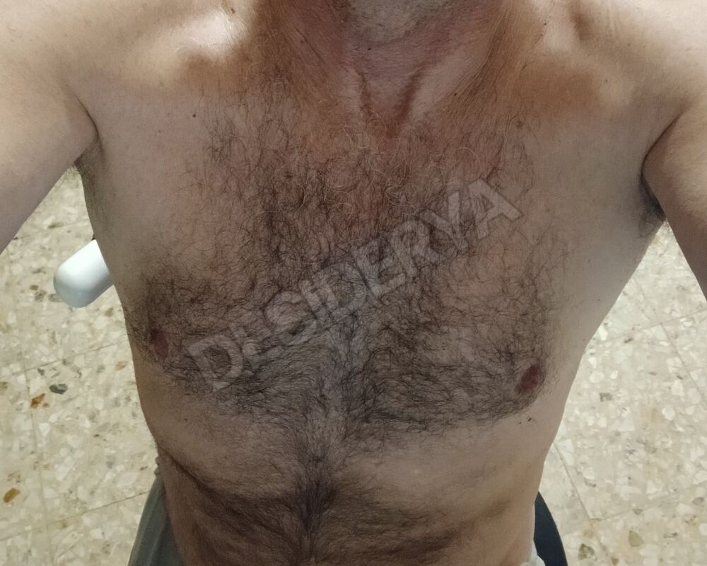 luca6815962303