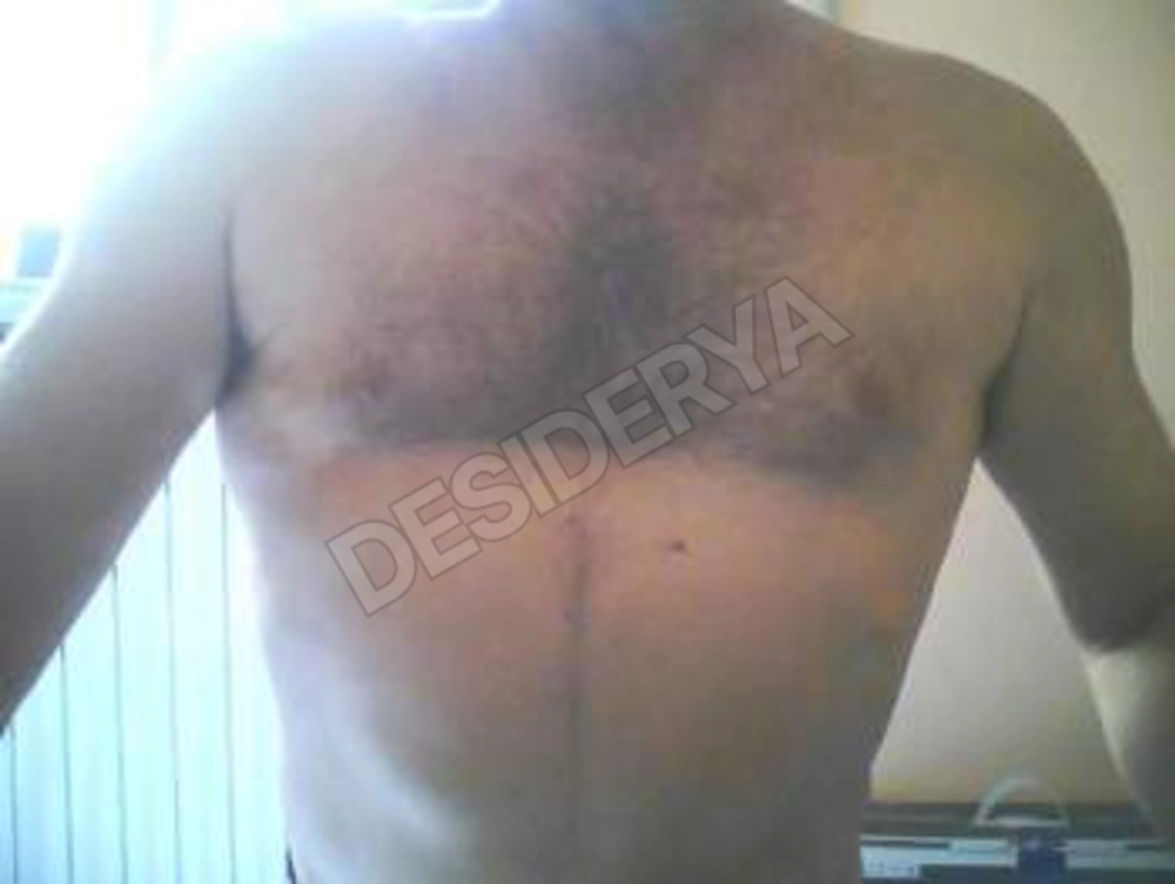 luposolitario02605574085
