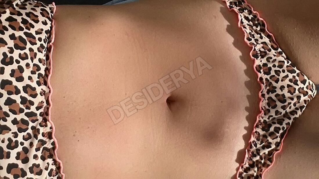 mammarm865956287