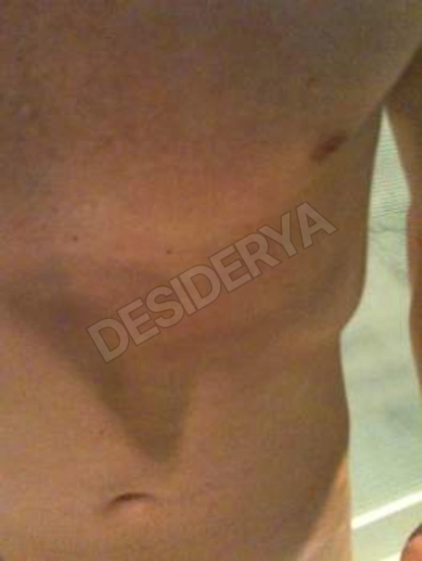 amea5328400