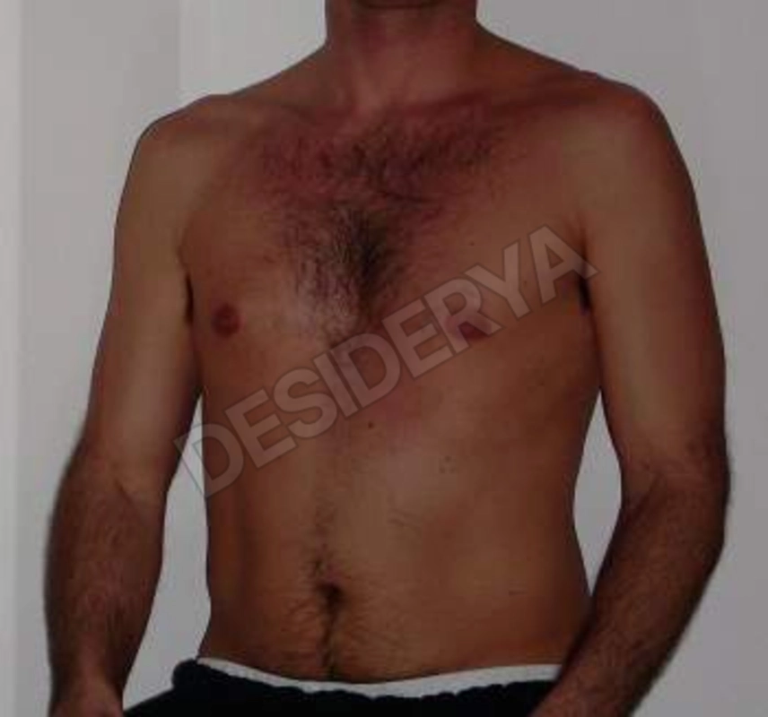 marcoblo5580538