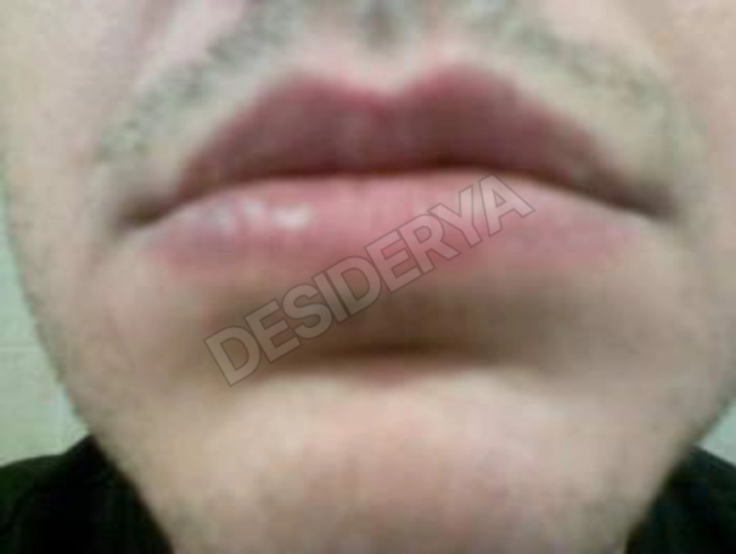 i1love1desy5314750