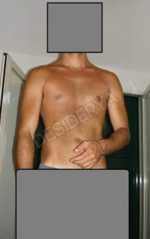 viacale5536245
