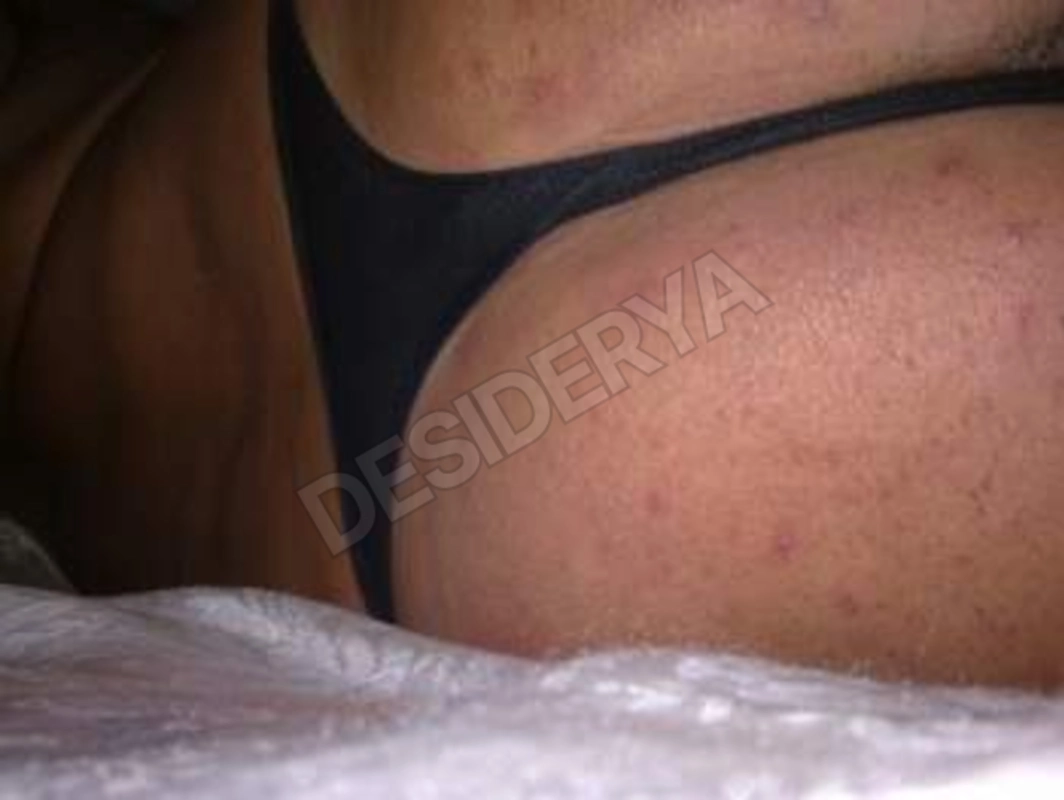 culoapertoxte5597003