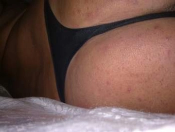 culoapertoxte